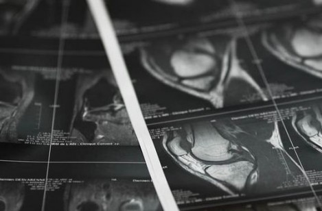 Dépassement autorisés ? Excès de vitesse !